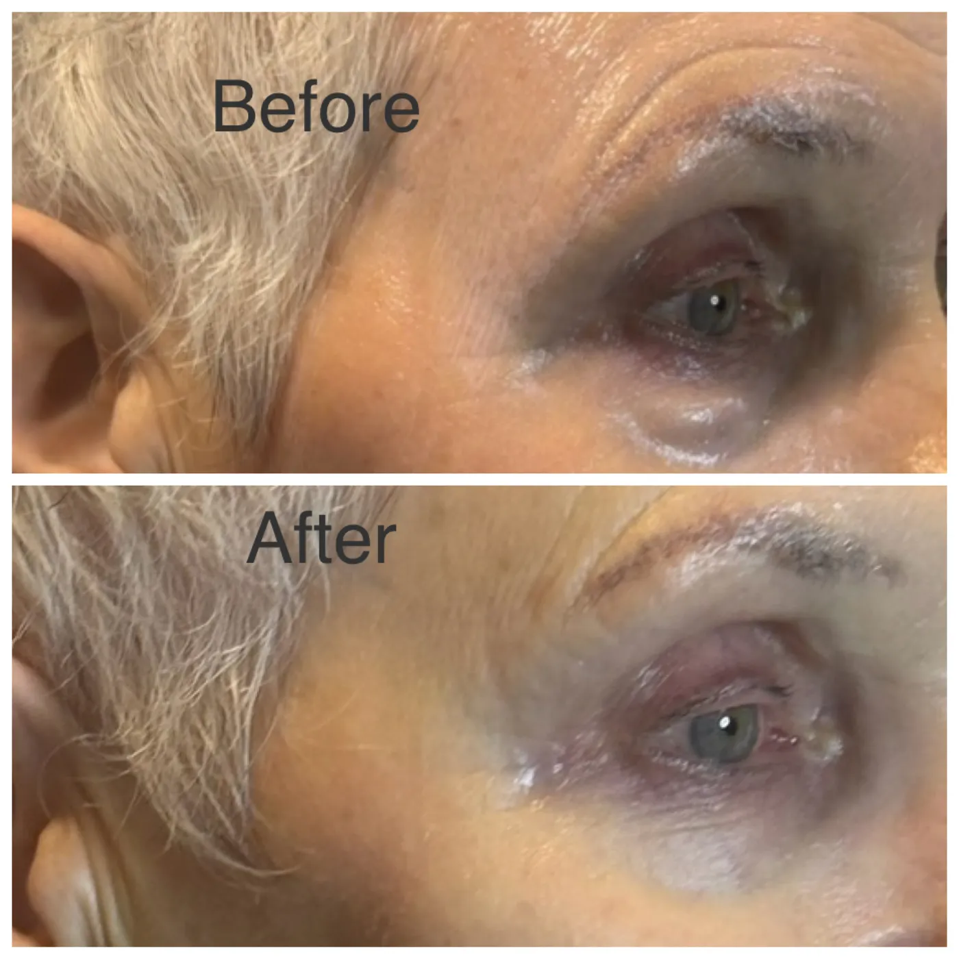 Microblading — Brow Definition